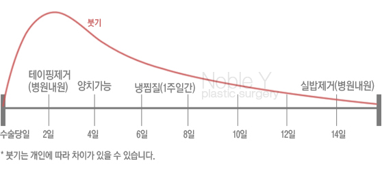 귀족수술